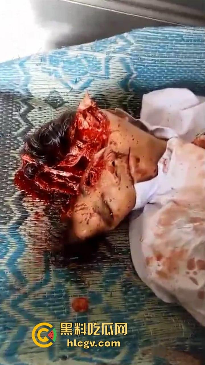 印尼惨烈车祸真实影像惨不忍睹 两人命丧车轮身首分离 胆小慎入-10