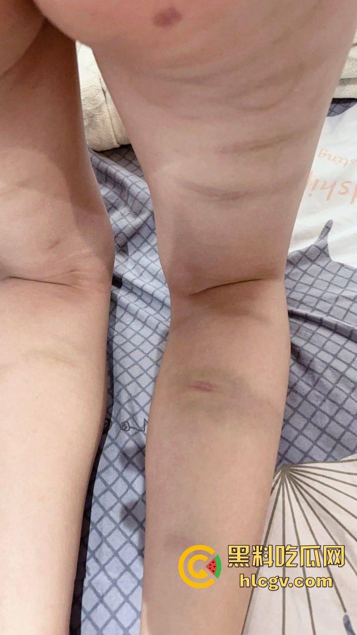 瓜友爆料约炮小红的悲惨故事,大专妹子被金钱调教,多人轮奸生活逼成这样,心疼不忍下屌!-10