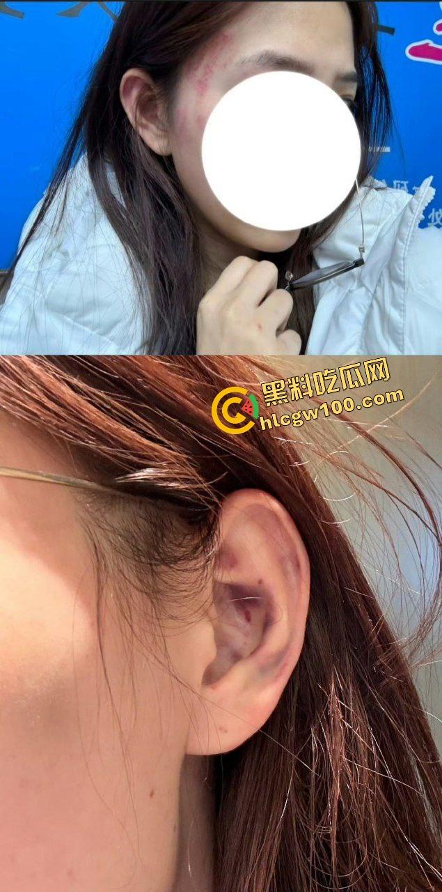 街球圈情侣大瓜！杭州街球手【程鑫凯】家暴女网红【鸡腿诺】多处打伤哭泣现场！独家开盒流出！-13