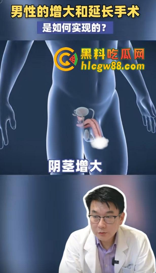 小鸟变大雕换炮计划!阴茎增大手术震撼实测 9CM秒变18CM战神之枪 ,这根真的压不住了!-7