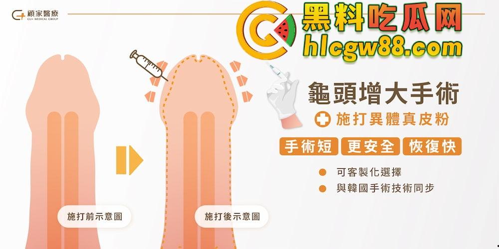 小鸟变大雕换炮计划!阴茎增大手术震撼实测 9CM秒变18CM战神之枪 ,这根真的压不住了!-9