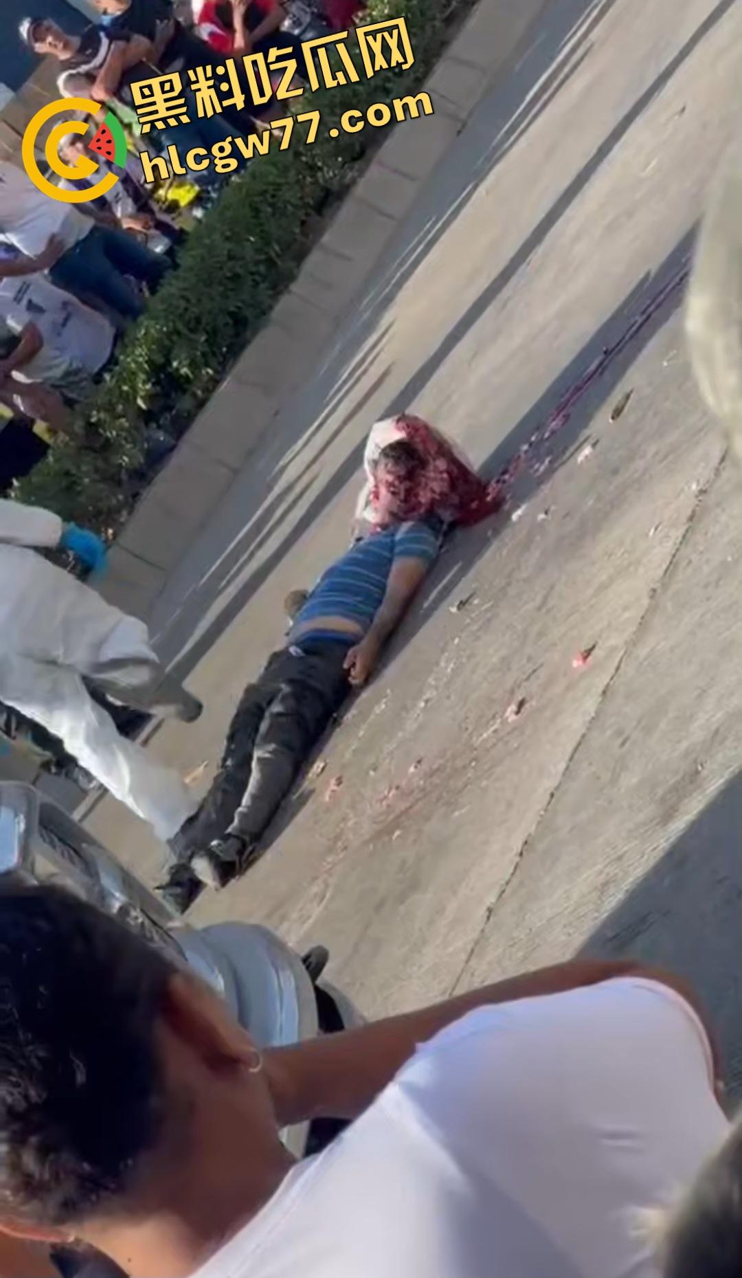 蓝色衣服男电动车车祸爆头血腥惨剧!眼珠弹出还能救?世上竟有神人?-1