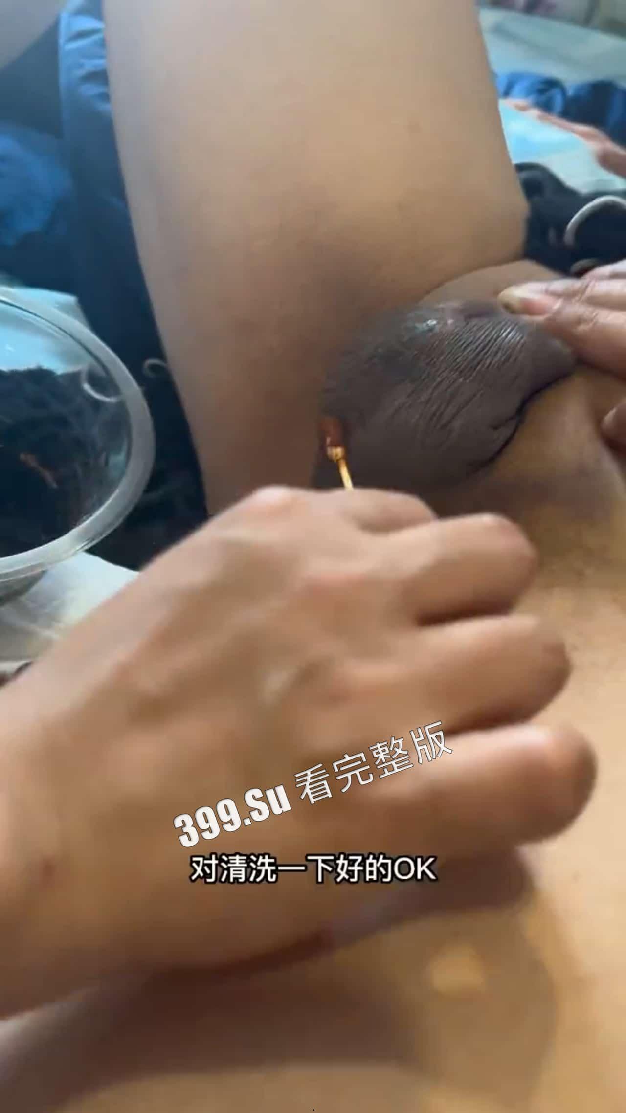 变性手术 术后实录 做女人啦!不过阴道真的有感觉嘛~瓜友们怎么看?-1