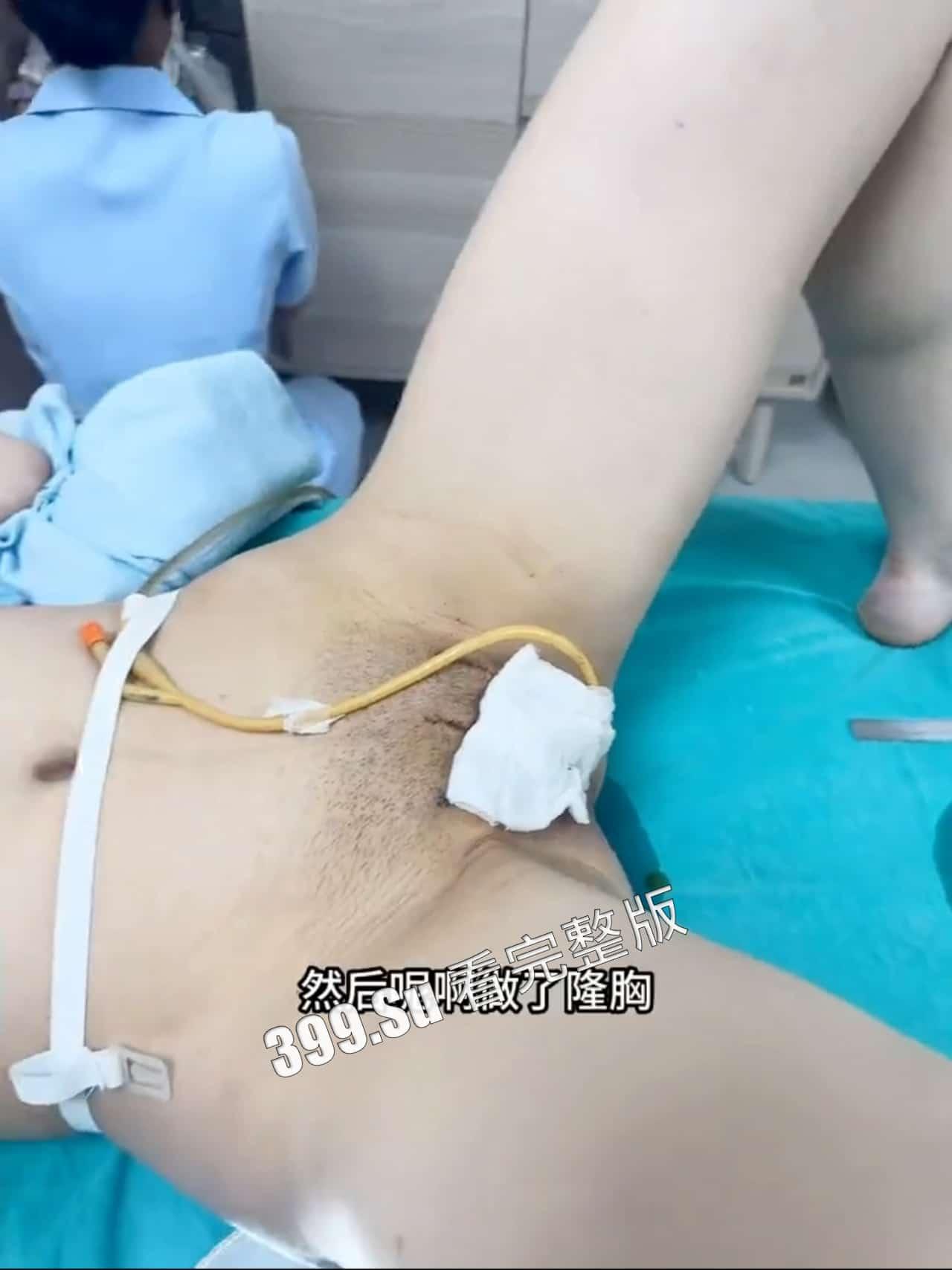 变性手术 术后实录 做女人啦!不过阴道真的有感觉嘛~瓜友们怎么看?-7