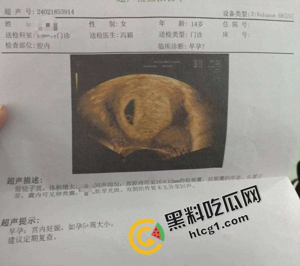 逆天事件!初中生14岁偷吃禁果 因为爽而不做措施无套内射 早孕发朋友圈炫耀-4