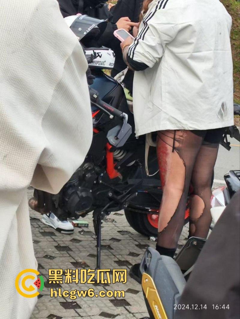 美图秀秀弱爆了 这才是真实磨皮!胖妹装逼压弯失控撞车 黑丝当场爆裂惨遭磨皮 大腿血肉模糊 真是悲惨又丢人!-1