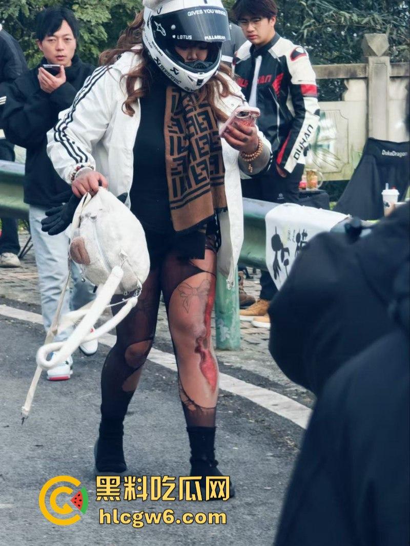 美图秀秀弱爆了 这才是真实磨皮!胖妹装逼压弯失控撞车 黑丝当场爆裂惨遭磨皮 大腿血肉模糊 真是悲惨又丢人!-4