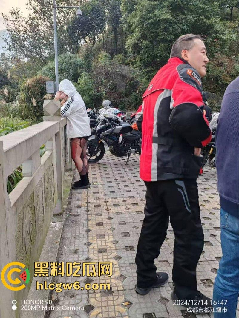 美图秀秀弱爆了 这才是真实磨皮!胖妹装逼压弯失控撞车 黑丝当场爆裂惨遭磨皮 大腿血肉模糊 真是悲惨又丢人!-6