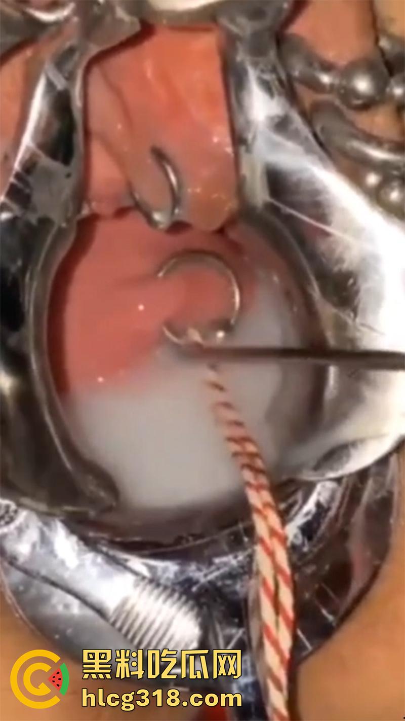 重口极限引导扩张虐穴,逼里塞图钉钢管插子宫口,鸡巴爆插尿道操的骚逼白浆四溢,宫颈真像个鱼唇!-8