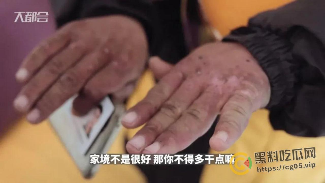 三年挣102w的外卖小哥【陈思】被打了?是炒作还是被嫉妒?-13