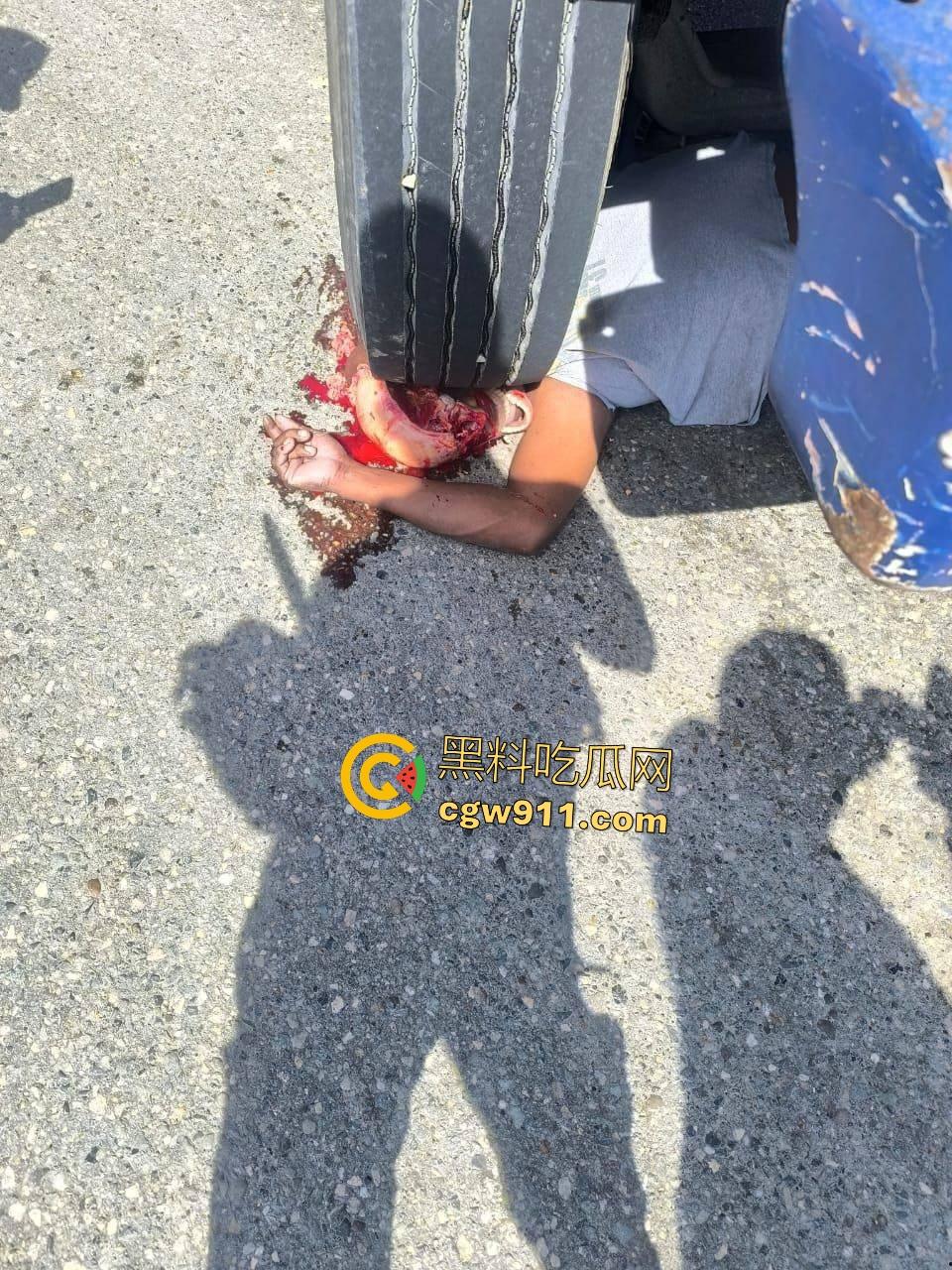 印尼摩托狂飙遭碾压!脑袋头皮刮飞露白骨,摩托吱吱狂响,车祸现场震碎人心,这还能救活吗?-1