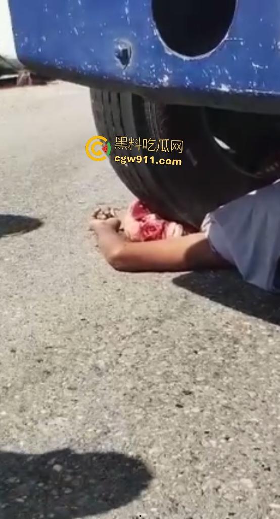 印尼摩托狂飙遭碾压!脑袋头皮刮飞露白骨,摩托吱吱狂响,车祸现场震碎人心,这还能救活吗?-7