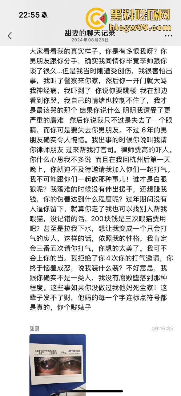 【夜场故事会】杭州混圈公主SM玩脱,被打爆一只眼,差点丢命!女生互撕背刺,骂战升级,闺蜜情比塑料还薄!-5