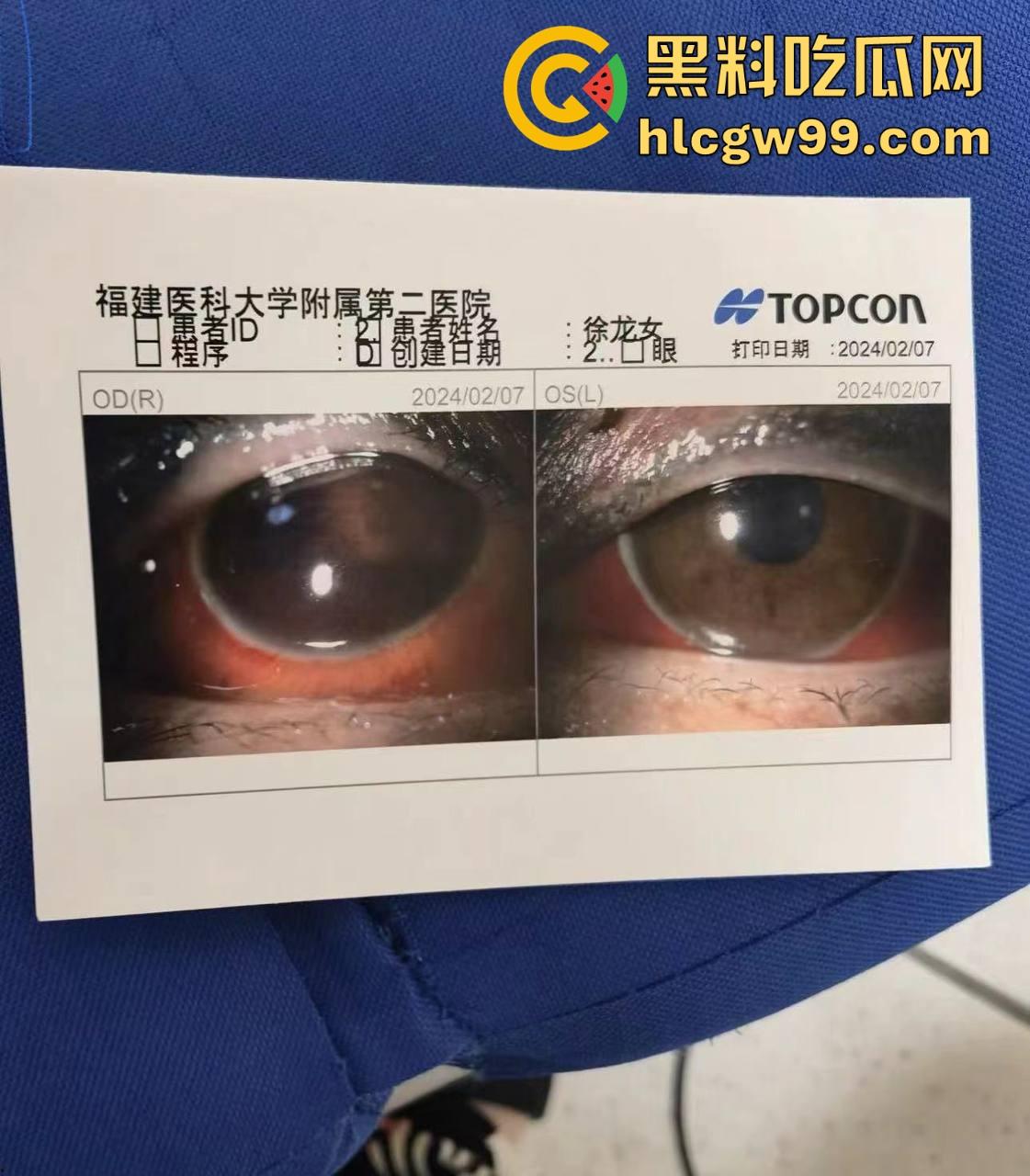 【夜场故事会】杭州混圈公主SM玩脱,被打爆一只眼,差点丢命!女生互撕背刺,骂战升级,闺蜜情比塑料还薄!-7