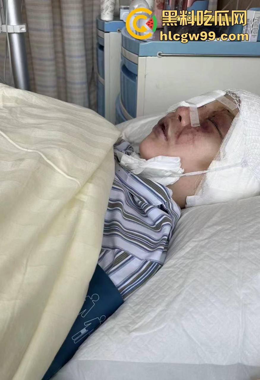 【夜场故事会】杭州混圈公主SM玩脱,被打爆一只眼,差点丢命!女生互撕背刺,骂战升级,闺蜜情比塑料还薄!-17