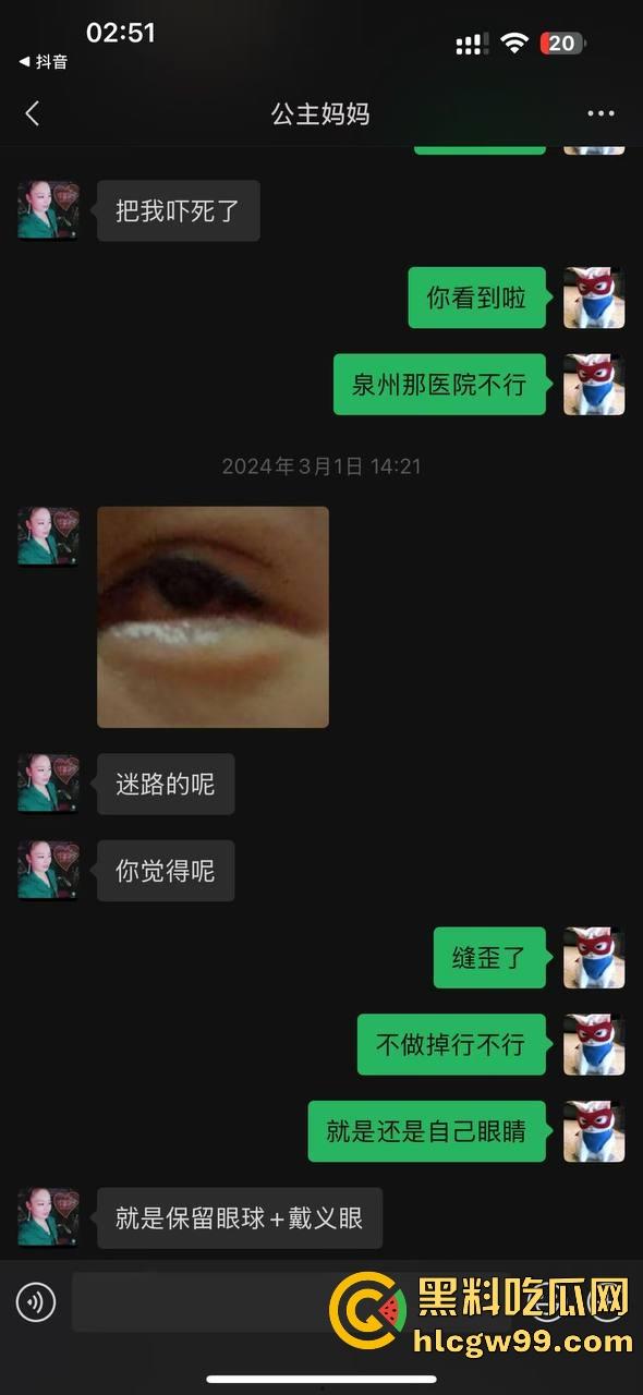 【夜场故事会】杭州混圈公主SM玩脱,被打爆一只眼,差点丢命!女生互撕背刺,骂战升级,闺蜜情比塑料还薄!-133