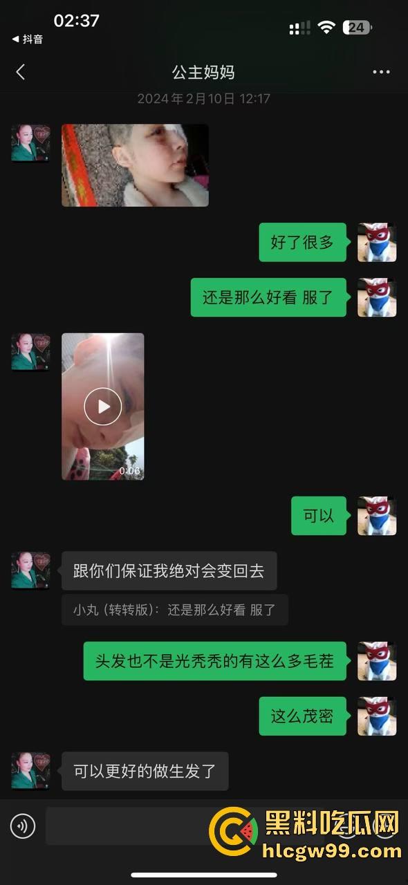 【夜场故事会】杭州混圈公主SM玩脱,被打爆一只眼,差点丢命!女生互撕背刺,骂战升级,闺蜜情比塑料还薄!-159