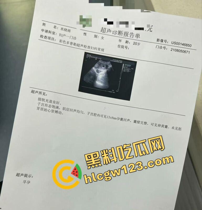 老套路玩不腻,江西老哥约小仙女无套爽完2周内直接中标!说怀孕就怀孕,喜当爹都反应不过来!-8