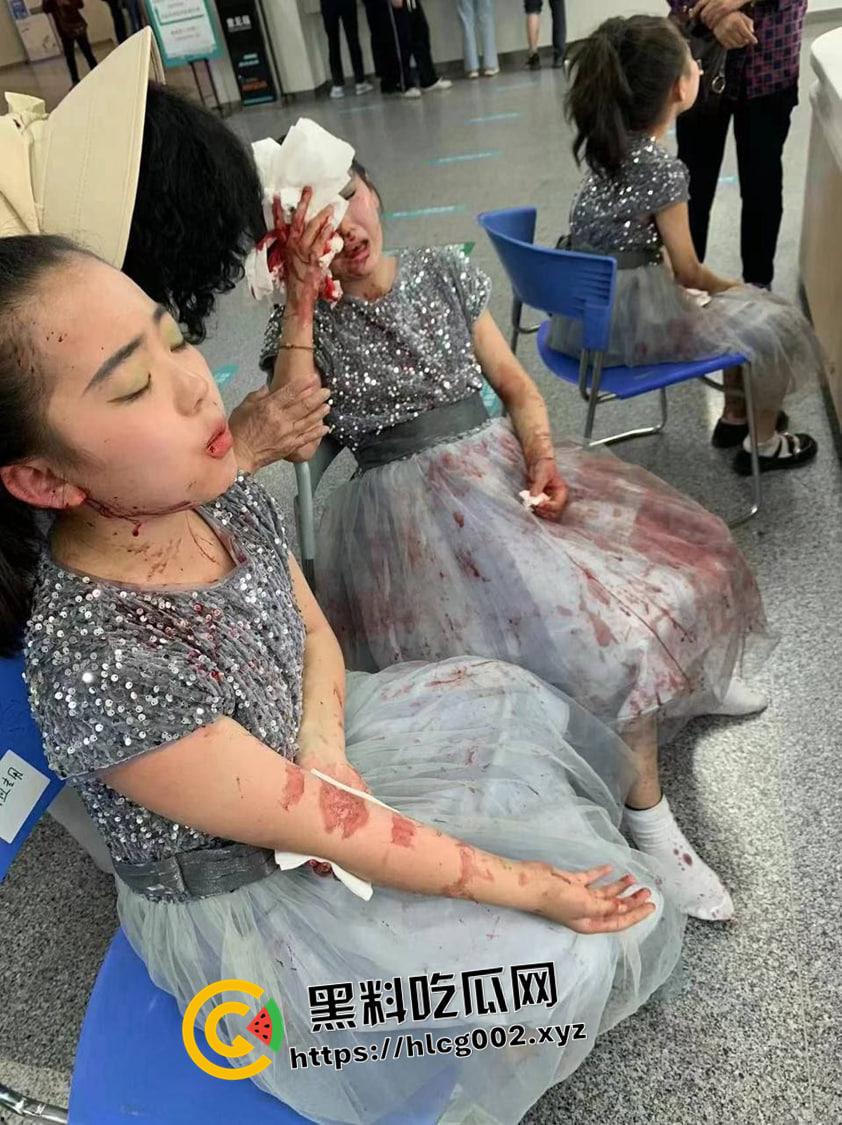 江苏南通渣土车撞翻装满春游学生的校车 死伤无数 一地尸体碎片 现场血腥视频流出-2