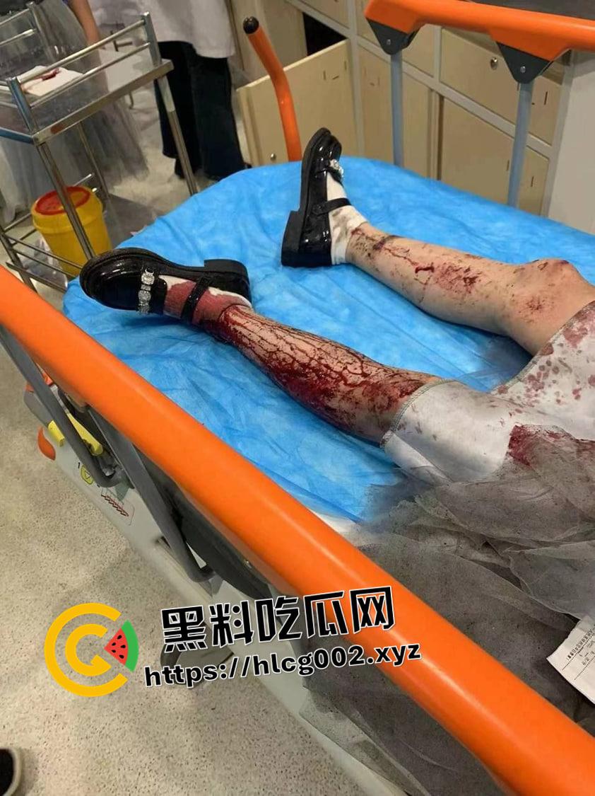 江苏南通渣土车撞翻装满春游学生的校车 死伤无数 一地尸体碎片 现场血腥视频流出-3