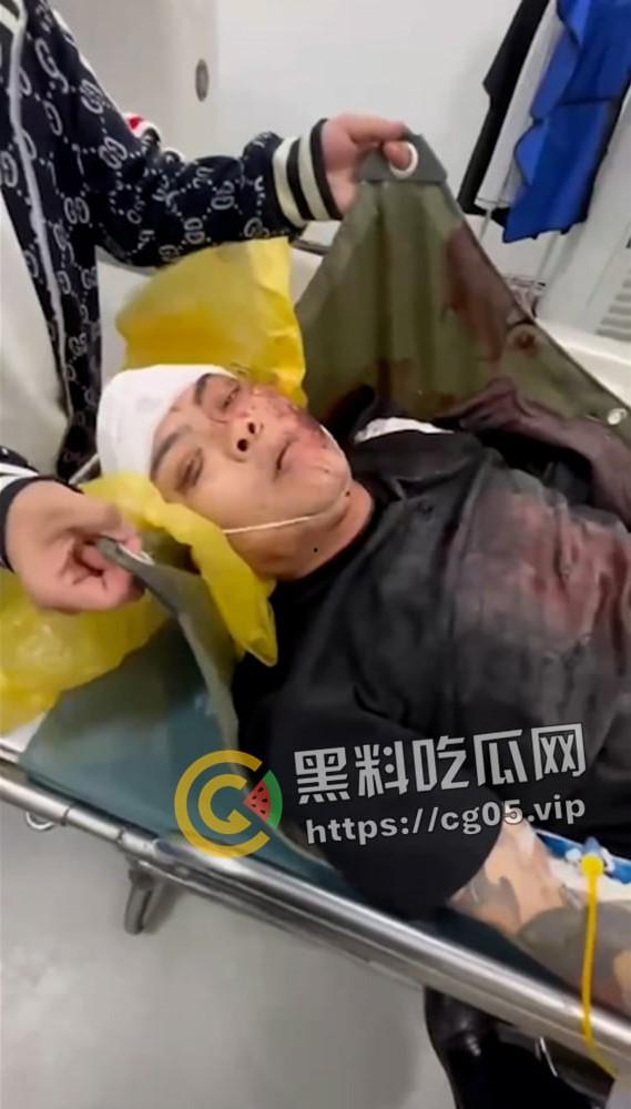 精神小伙哈尔滨斯卡拉迪厅前挑衅！上一秒嚣张至极 下一秒被打成猪头 活该-5