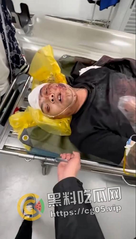 精神小伙哈尔滨斯卡拉迪厅前挑衅！上一秒嚣张至极 下一秒被打成猪头 活该-6