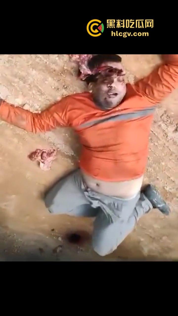 太惨了!因操作不当 巴西倒霉男子脑袋被挤爆 血腥现场视频曝光 胆小慎入-9