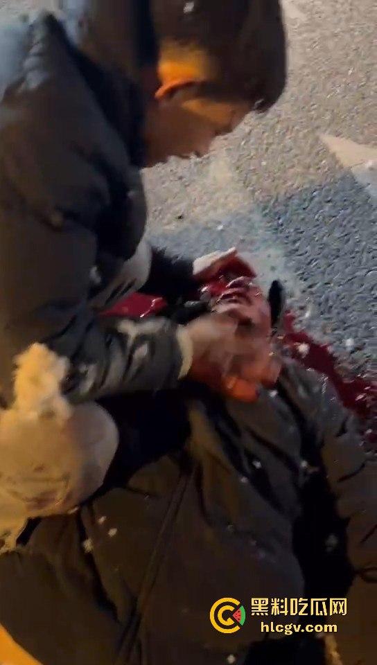 西安立交桥两男子醉酒骑摩托撞护栏，一男子爆头止血，没想到面包车又来补一刀！-10