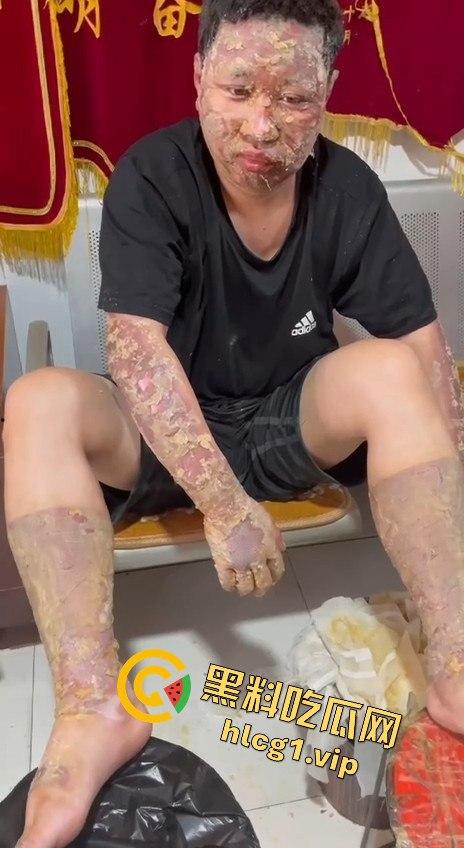 内蒙古呼和浩特惊魂一刻!02年精神小伙偷骑V4机车撞上右转SUV,摩托车当场燃烧!-8