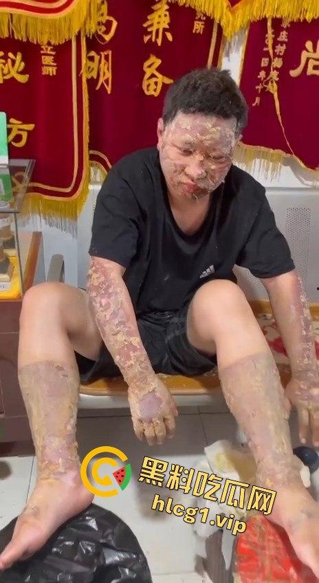 内蒙古呼和浩特惊魂一刻!02年精神小伙偷骑V4机车撞上右转SUV,摩托车当场燃烧!-10