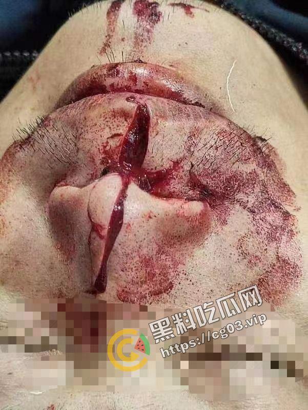 嚣张!广西容县城北路少年砍人 与警察互博 砍伤警察 拒不伏法 嚣张至极-5