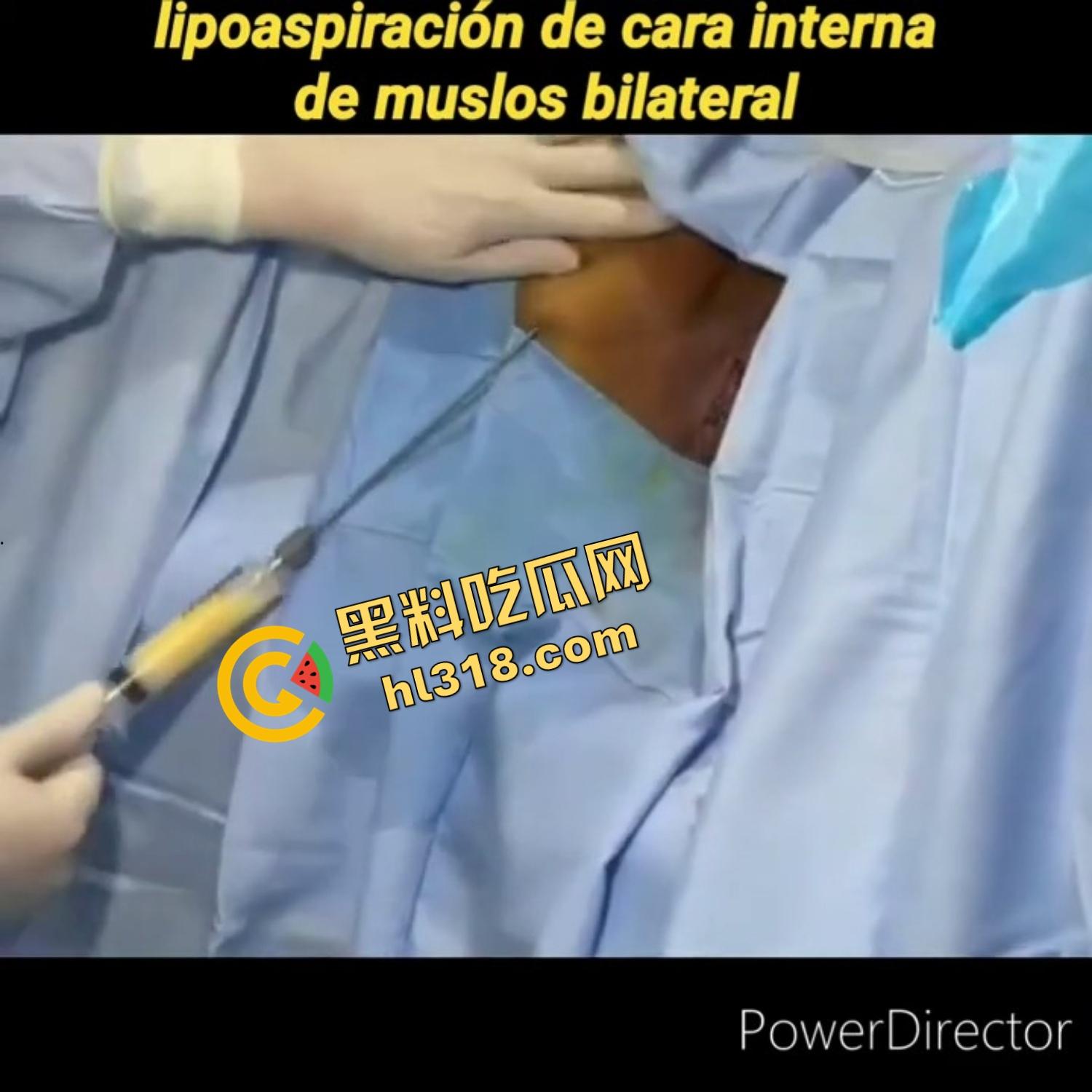 人工白虎一线天馒头逼逆天改命全流程，激光割黑阴唇，手术后完美蜕变，这才是新时代白虎一线天！-13