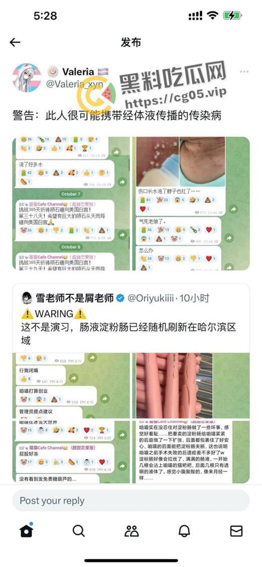 毁三观!逆天男娘在哈尔滨投毒被举报 性病晚期浑身流脓还准备卖塞进过自己直肠的烤肠创业 被热心群友举报进局子-4