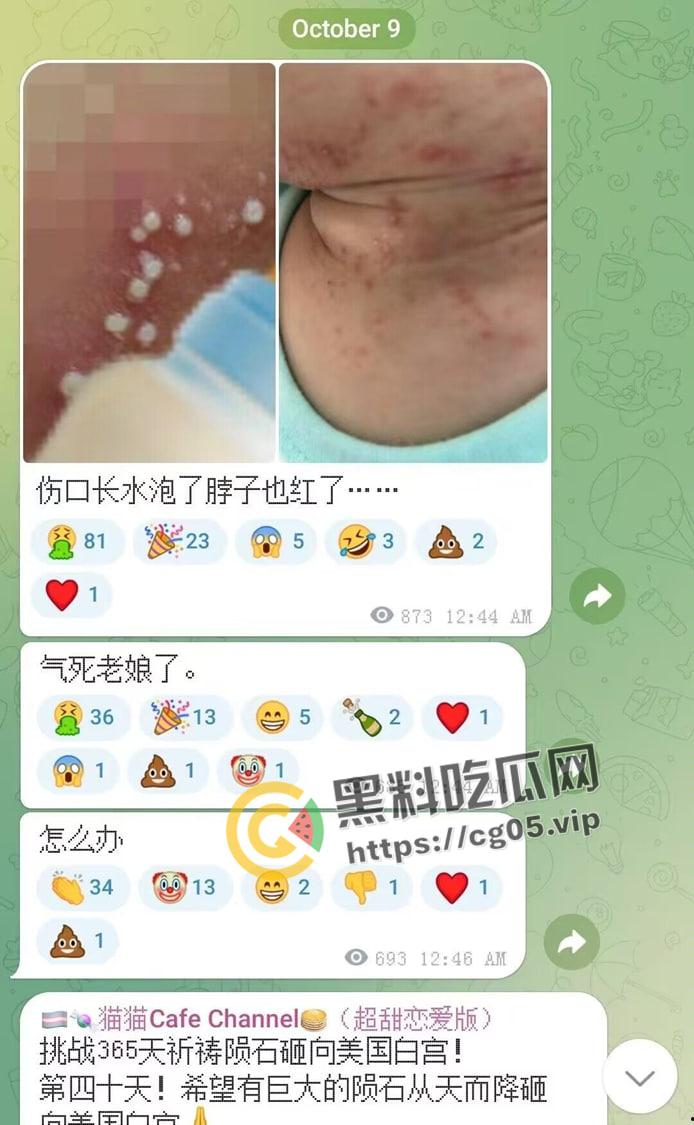 毁三观!逆天男娘在哈尔滨投毒被举报 性病晚期浑身流脓还准备卖塞进过自己直肠的烤肠创业 被热心群友举报进局子-10