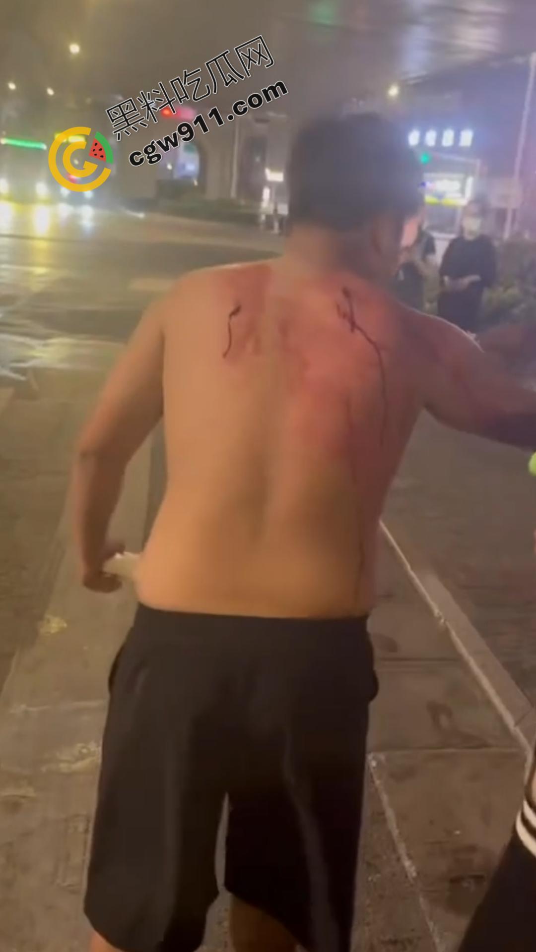 闹市惊现“刀妹狂魔”:穿着黑丝狂捅一男子,刀光四射,溅血街头,网络梗喧腾,路人惊逃-10