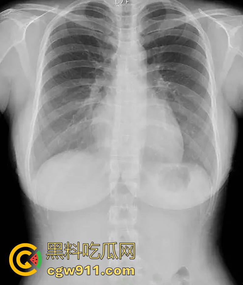 湾湾成人展来啦!现场拍摄新进女优【天木纯】,颜值可爱巨乳傲人,展示CT片自证美乳真实,天然大奶的确奶味十足!-2