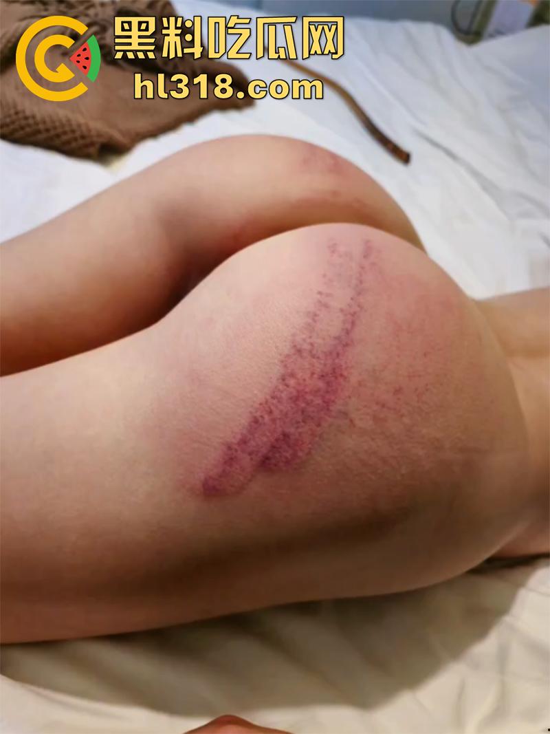 高颜值翘臀母狗,被调教打屁股虐阴合集,自愿当公交车被人轮流操,抽奶扇耳光抽到起飞,淫水都淌拉丝了!-3