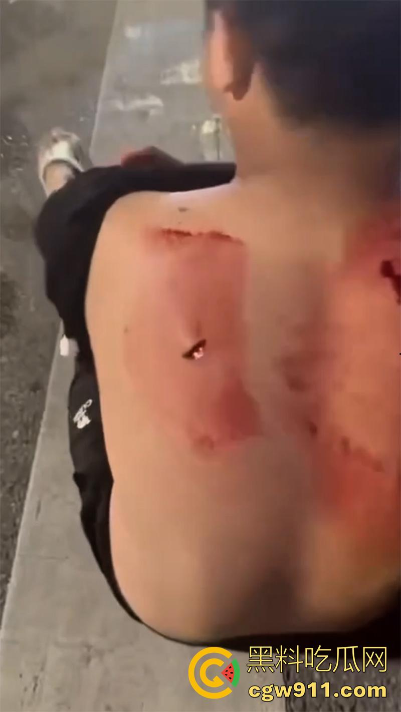 江西赣州第七中学,精神小伙小妹发生口角,叫人斗殴持砍刀砍人,警方和120急救人员陆续赶到,现场多人受伤。-4