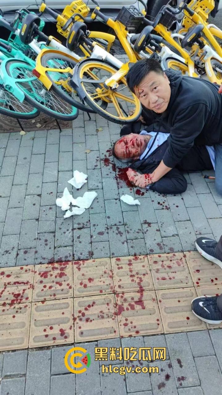 没人性!北京海淀区男子当街砍人报复社会 专挑孩子下手 现场血腥惨烈视频曝光-11