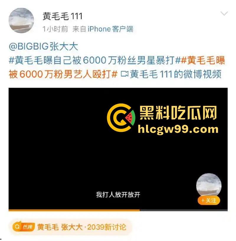 抖音黄毛毛自爆,6000万粉丝顶流男艺人『张大大』酒店暴打女编剧,2小时枕头玻璃杯狂砸,逼她下跪道歉!-25