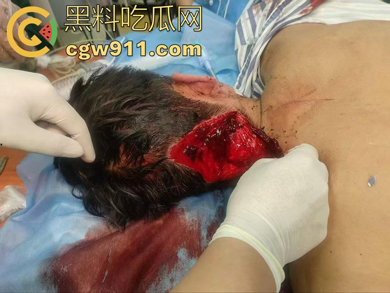 退伍兵都憋坏了吧,酒吧遇到认识的美女,直接上手撩骚,其表哥上前理论被群殴,提刀一穿四,这兵真是白当了!-2