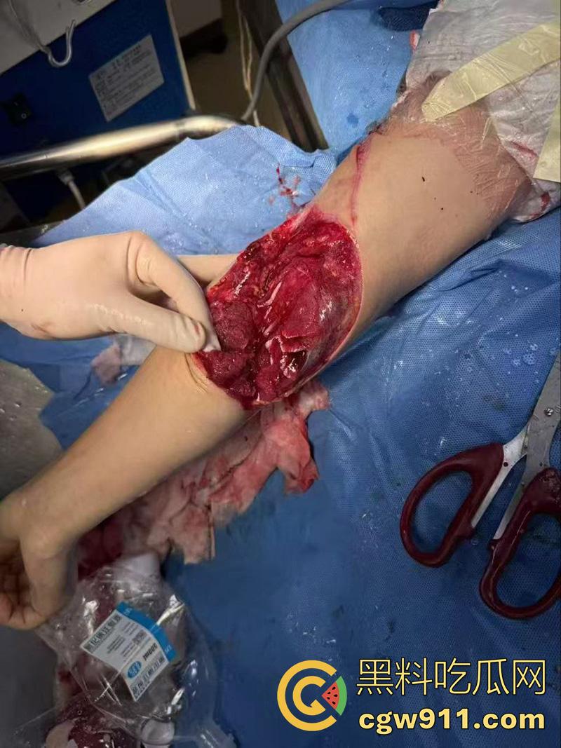 退伍兵都憋坏了吧,酒吧遇到认识的美女,直接上手撩骚,其表哥上前理论被群殴,提刀一穿四,这兵真是白当了!-3