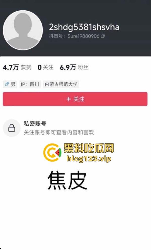 软饭小王子『焦皮』!抱富婆、撩老头,变性网红『智博』钱袋被掏空,软饭吃到爽!-2