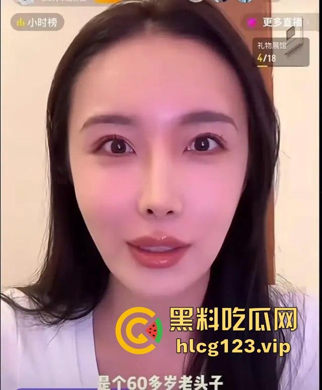 软饭小王子『焦皮』!抱富婆、撩老头,变性网红『智博』钱袋被掏空,软饭吃到爽!-15