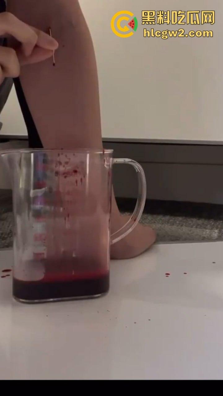 血腥慎入！推特十级脑残血腥自残自拍 残暴割腕引血自流 这是作死还是变态？-3