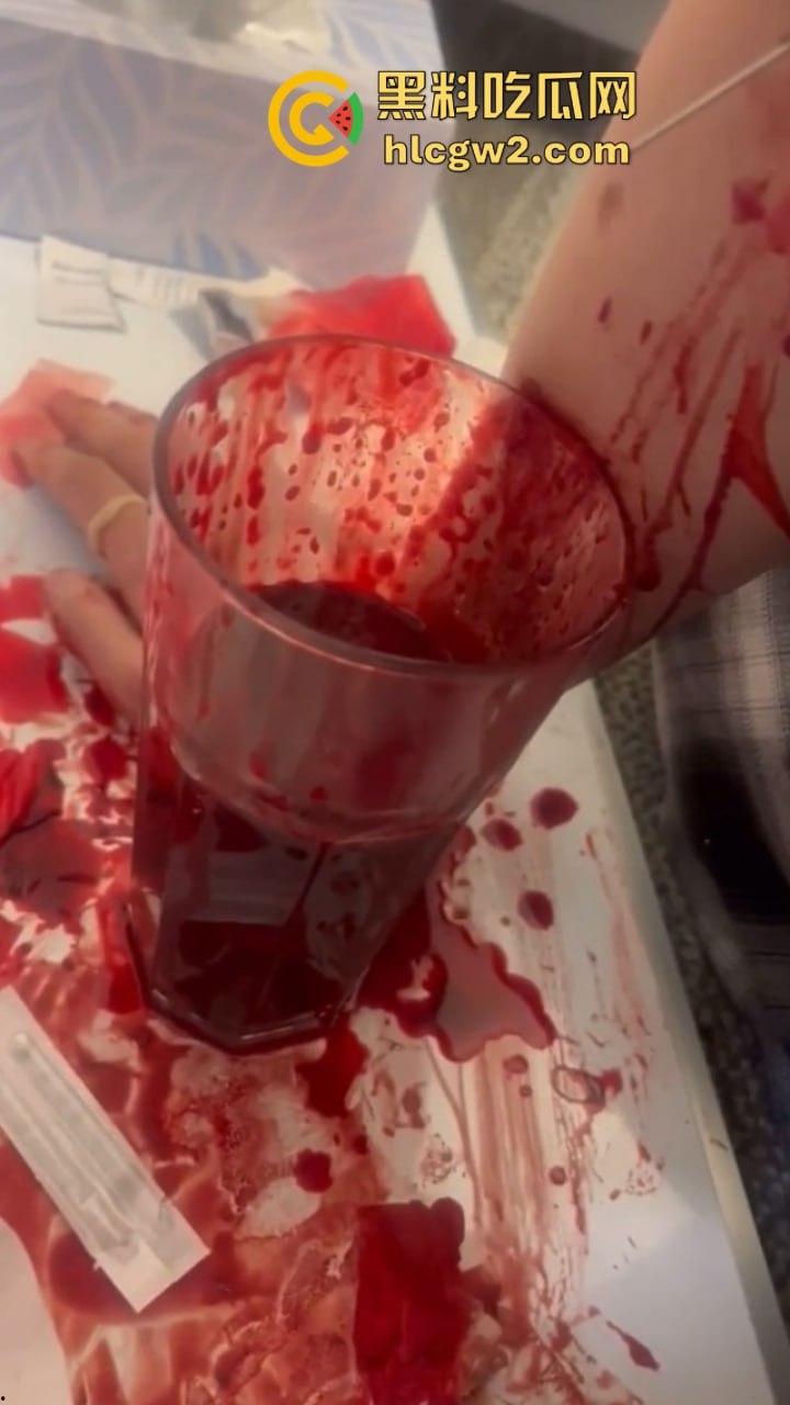 血腥慎入！推特十级脑残血腥自残自拍 残暴割腕引血自流 这是作死还是变态？-8