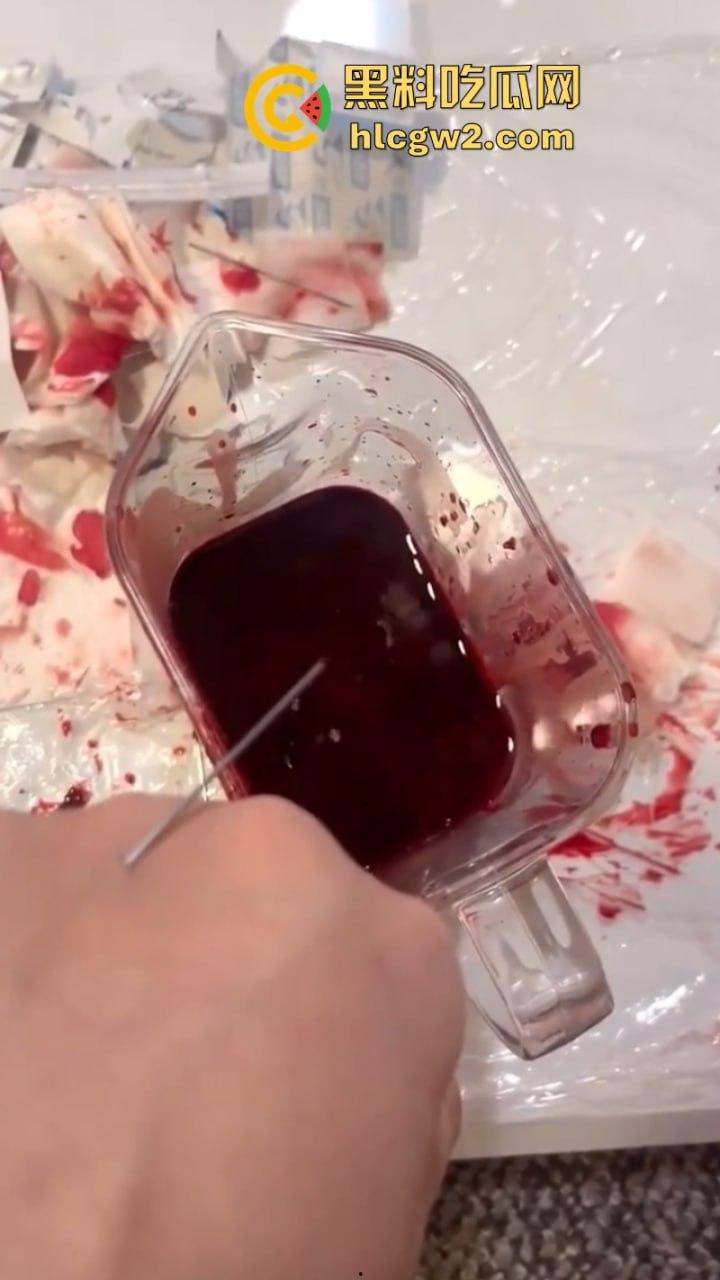 血腥慎入！推特十级脑残血腥自残自拍 残暴割腕引血自流 这是作死还是变态？-9