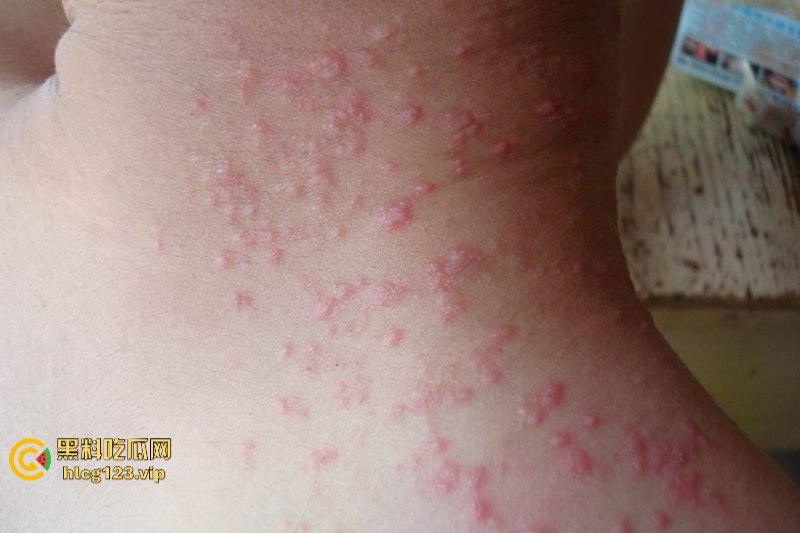 可怕!为了报复社会把带血针头扎进了共享单车的座椅里……山东商业技师学校20个被感染艾滋!!!-8