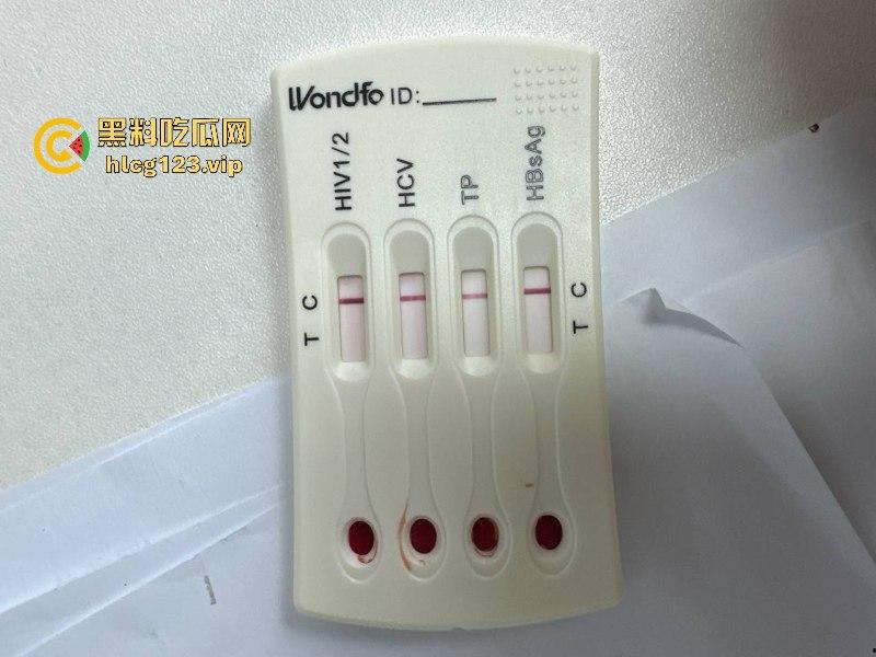 可怕!为了报复社会把带血针头扎进了共享单车的座椅里……山东商业技师学校20个被感染艾滋!!!-9