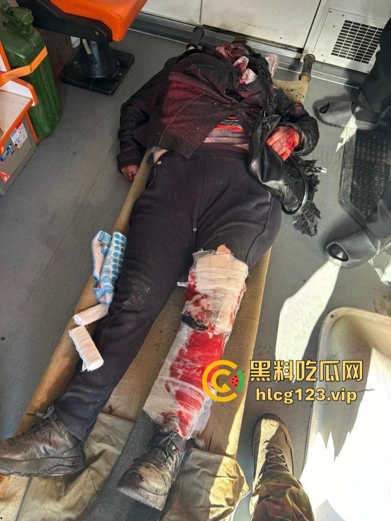 坐等看戏!伊朗对以色列的导弹袭击已结束 美准备好对抗伊朗?内含血腥无码画面 慎入!!!-6